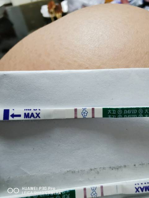 精子库精子做供卵做试管婴儿厦门捐精者补贴费用