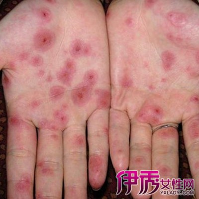 一次供卵试管婴儿移植的成功率是多少？