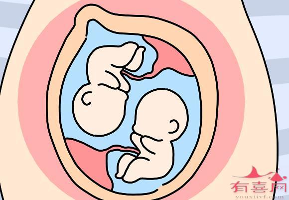 解读三代借卵做助孕供卵试管是什么意思pgt：主要细分为三种不同的技术