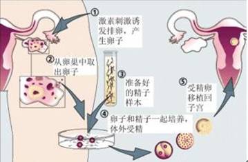 做借卵试管移植在月经第几天移植