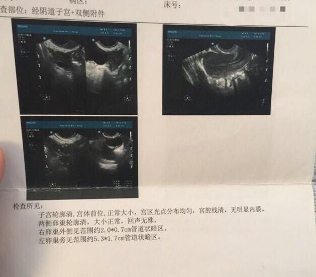 福建厦门省哪个医院做试管成功率最高