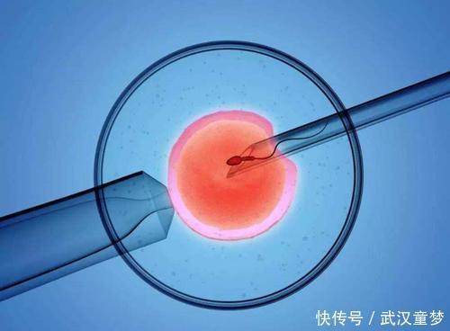 男性前向运动精子26%算弱精吗
