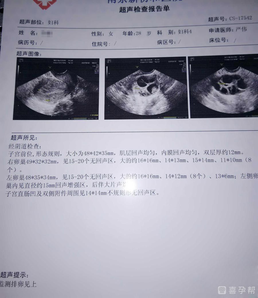 喜讯!厦门试管借卵“为您解答”